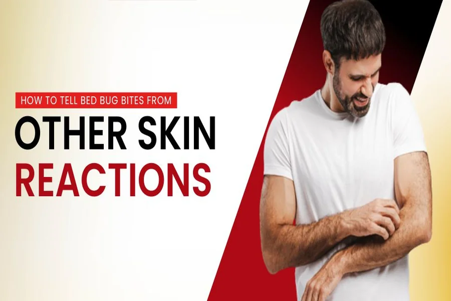 How to Tell Bed Bug Bites from Other Skin Reactions