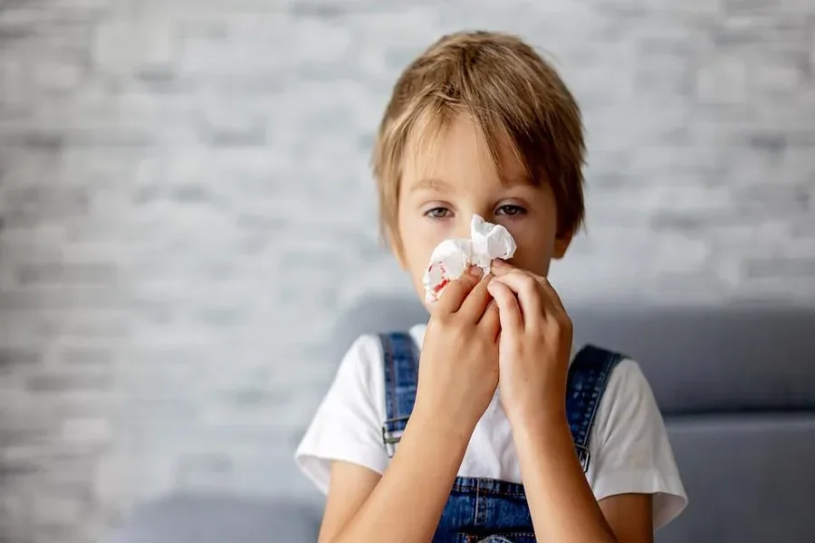 Nosebleeds in Children