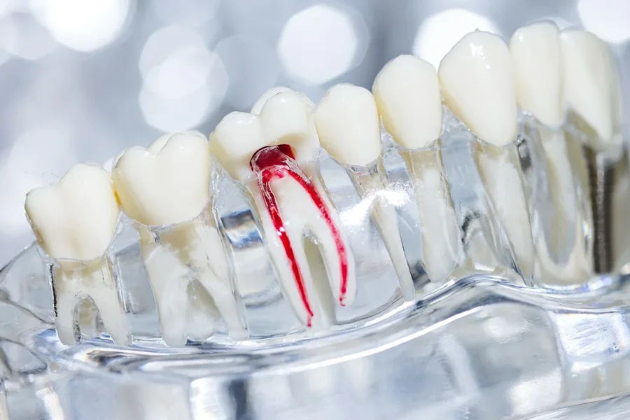 Damaged Teeth